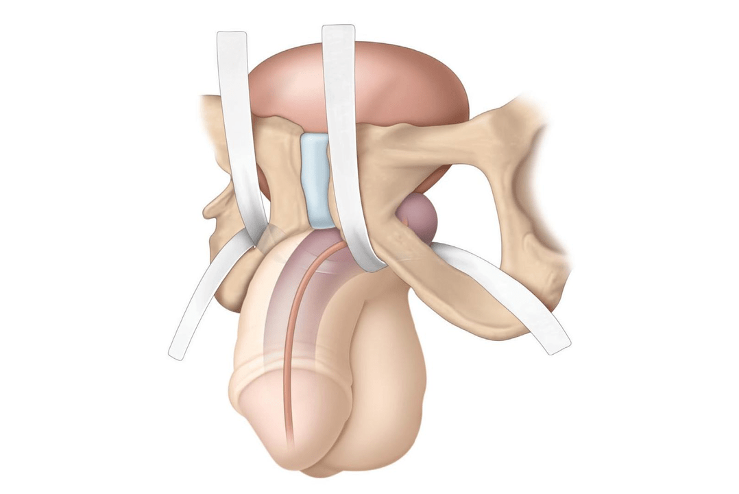 the presence of the filler is checked