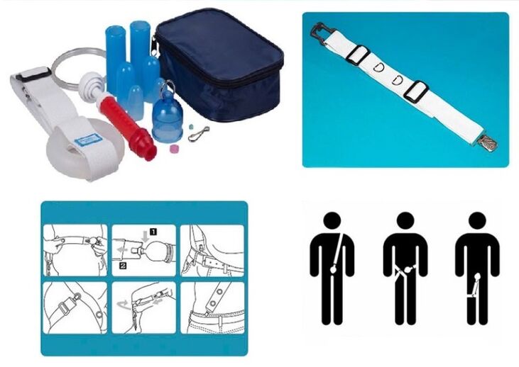 Lengthening and widening of the penis can be achieved on a stretcher